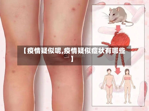 【疫情疑似呢,疫情疑似症状有哪些】