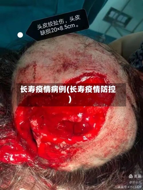 长寿疫情病例(长寿疫情防控)