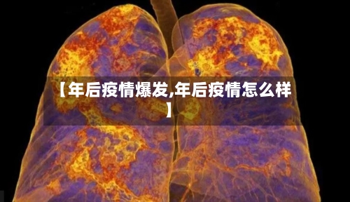 【年后疫情爆发,年后疫情怎么样】